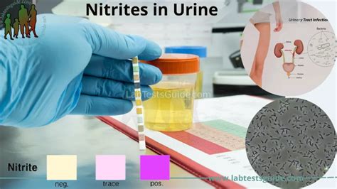 Nitrites In Urine Test Overview Procedure Results Interpretation