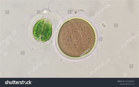 Cyanobacteria Called Chroococcus Sp 400x Microscope Stock Photo