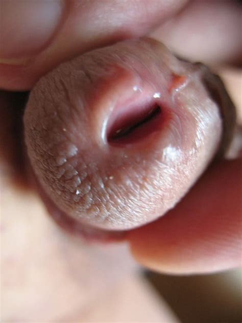 Open Peehole Nude Pics Xhamster