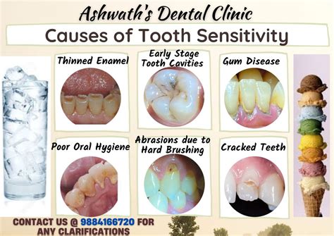 Causes For Tooth Sensitivity Artofit