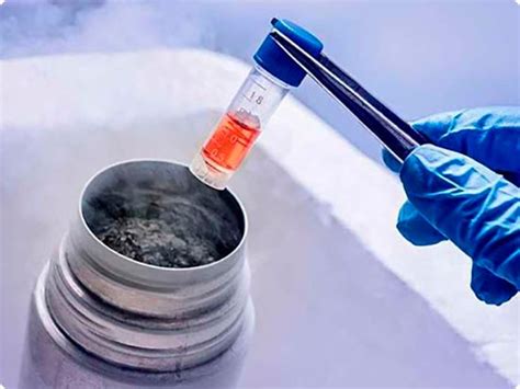 Frozen Embryo Transfer Timeline Cyprus IVF Center