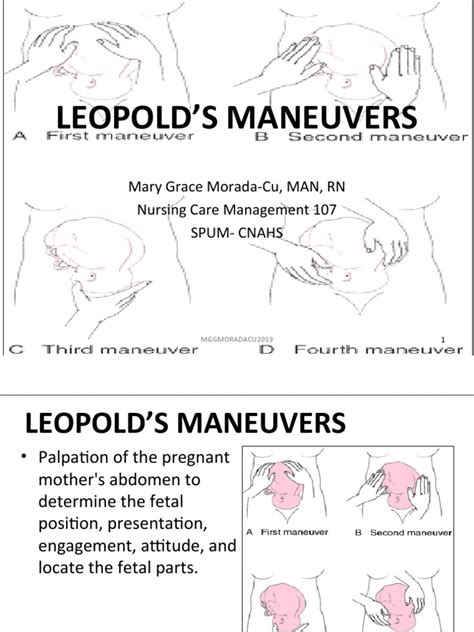 Leopolds Maneuvers Pdf Uterus Fetus