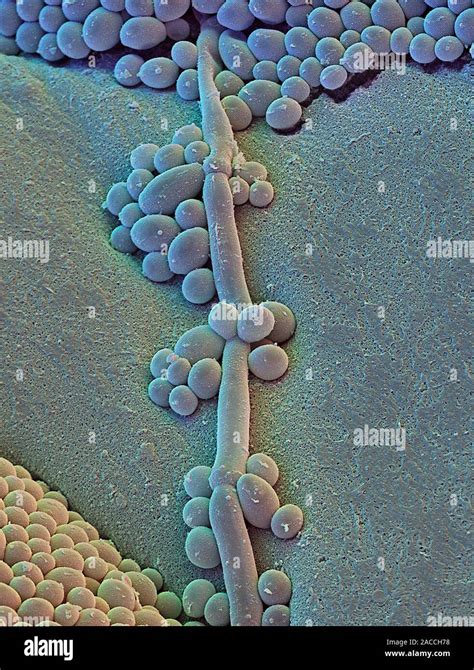 Candida Albicans Coloured Scanning Electron Micrograph Sem Of The