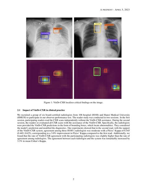 Evaluating The Impact Of An Explainable Machine Learning System On The