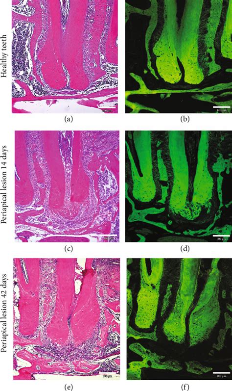 Figure 2 From Detection Of Apical Dental Resorption Caused By Endodontic Infection In Mice Using