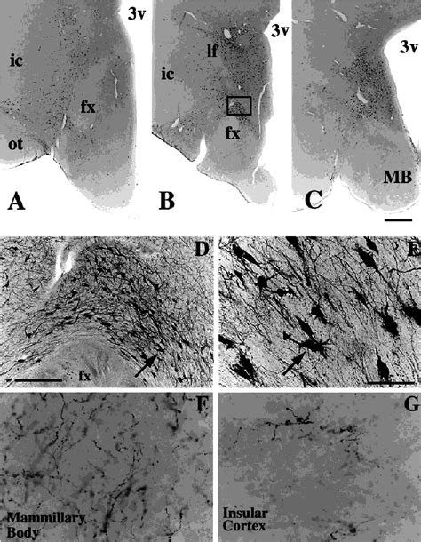 Series Of Photomicrographs Demonstrate That Mch Ir Neurons Are Present