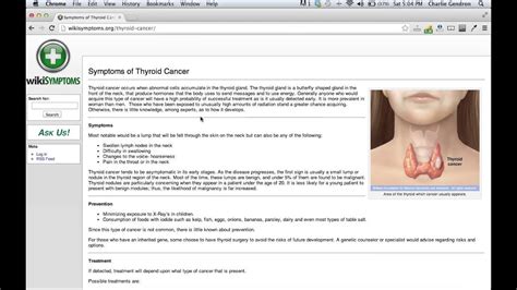 Thyroid Cancer Signs And Symptoms Wikisymptoms Youtube