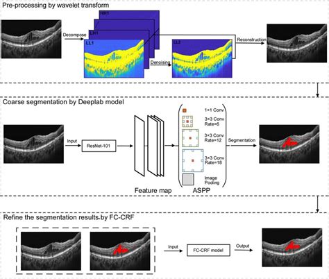 Flowchart Of Oct Deeplab Method Download Scientific Diagram
