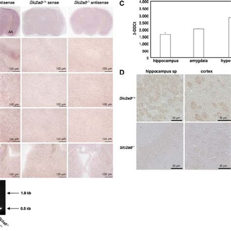 Analyses Of Glut Expression In Mouse Brains By In Situ Hybridization