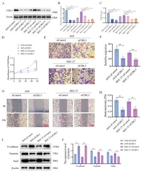 F Rl Regulates Epithelial Mesenchymal Transition And Angiogenesis In