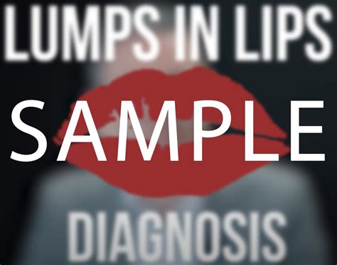 Lumps In Lips Diagnose Manage Treat Dr Tim Pearce Elearning