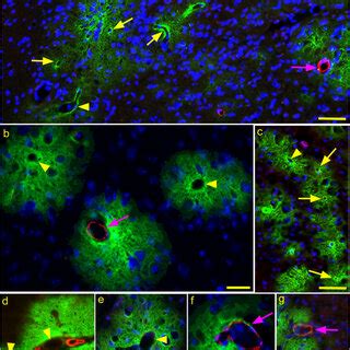 Immunofluorescence Detection Of PrPres And ASMA In Brain Tissue Of