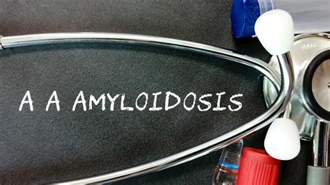 Amyloidosis: Causes, Symptoms, Diagnosis And Treatment | OnlyMyHealth