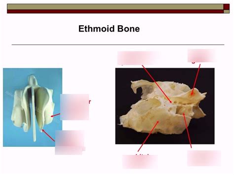 Ethmoid Bone Diagram | Quizlet