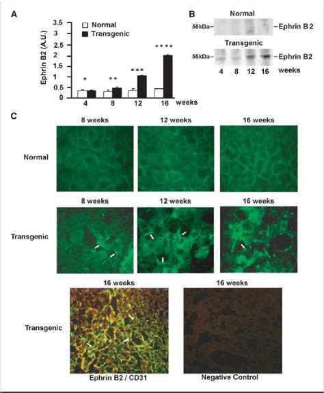 Figure From The Role Of The Vascular Endothelial Growth Factor Delta