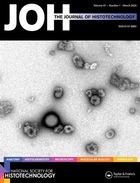 Application Of Electron Microscopy In Virus Diagnosis And Advanced