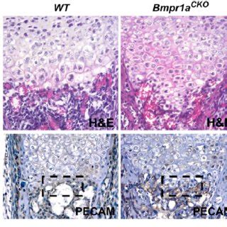 Defects In Hypertrophic Differentiation In Bmpr1a CKO Mice A E14 5