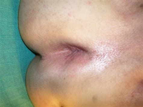 My Ass Ready For Cock Pics Xhamster