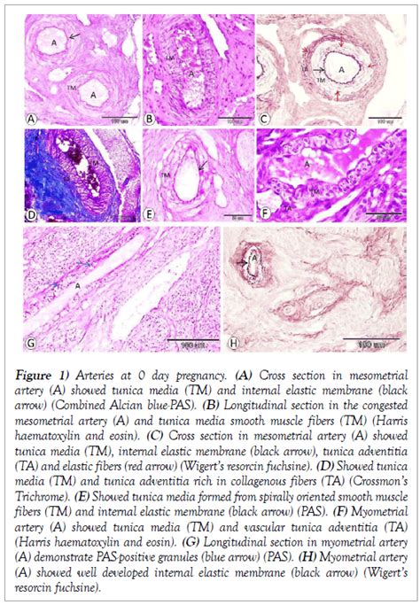 Arcuate Artery Histology