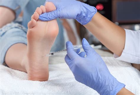 Plantar Fasciitis And Cortisone Injections Piedréseau