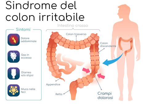 Scienza Consigli Per Intestino Irritabile Ma Di Cosa Si Tratta