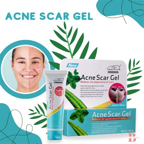 Acne Scar Gel Acne Scar Remover Pimple Mark Cream Dark Spot Remover