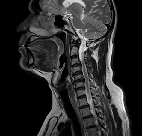 Mri Soft Tissue Hot Sex Picture