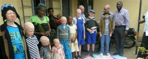 People With Albinism In Uganda Albinism Status Update 2020 Scosp