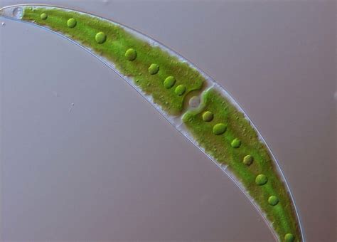 Closterium A Common Genera Of Green Algae Chlorophyta Nikon Small