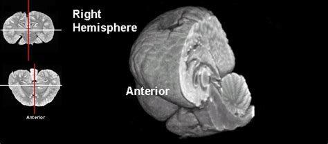 The Dolphin Brain Atlas at Michigan State University