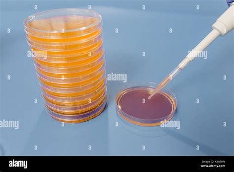 Petri Dish Blood Agar Culture Stock Photos Petri Dish Blood Agar