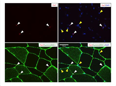 Representative Image Of A Muscle Cross Section Stained For Pax7