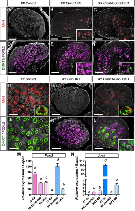 Consequences of inactivation of both b-catenin and Sox9 in the gonads ... 