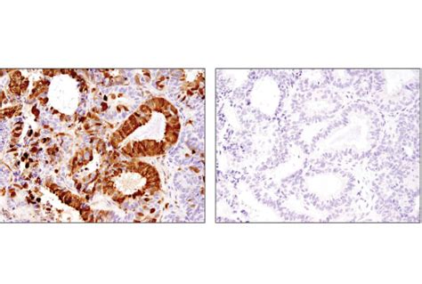 Galectin 3 LGALS3 D4I2R XP Rabbit MAb Cell Signaling Technology