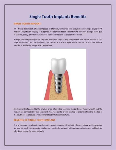 PPT Single Tooth Implant Benefits PowerPoint Presentation Free