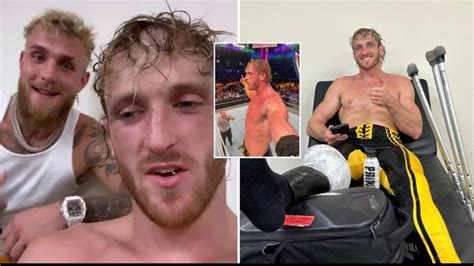 Logan Paul Reveals He Suffered An Injury At Wwe Crown Jewel Event