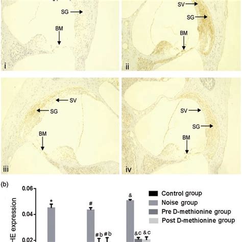 4 Hydroxynonenal 4 Hne Staining In The Basement Membrane Stria Download Scientific Diagram