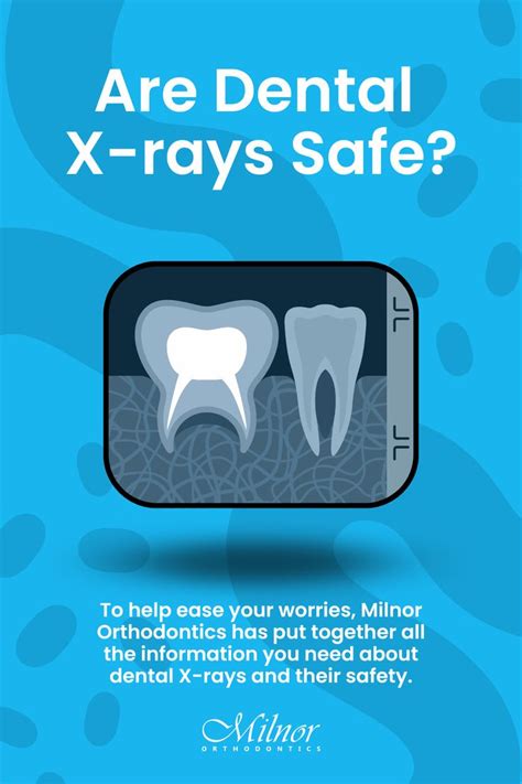 Are Dental X Rays Safe