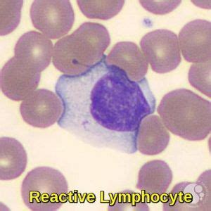 Blood Morphology Ask Hematologist Understand Hematology