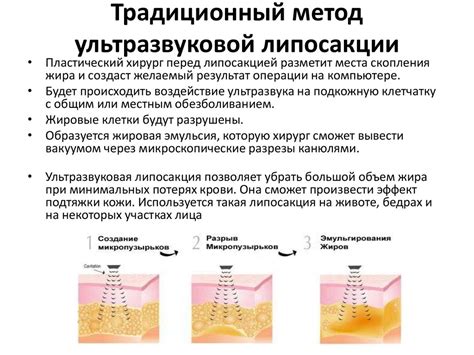 Липосакция - презентация онлайн
