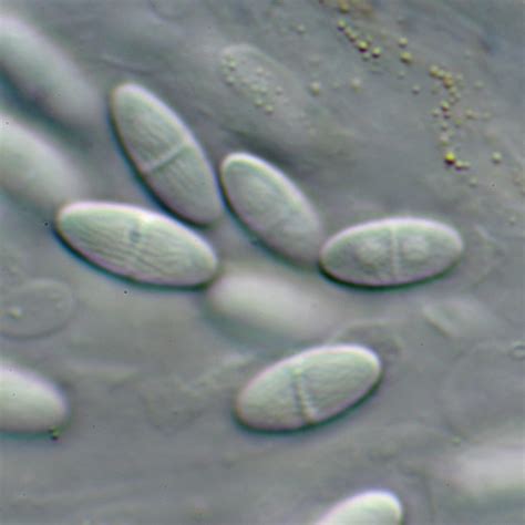 Hydropisphaera Peziza