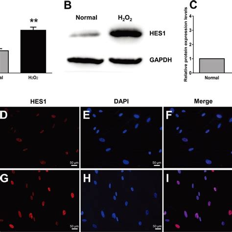 HES1 Knockdown Abrogated The Up Regulation Of ECM Proteins In The HTMCs