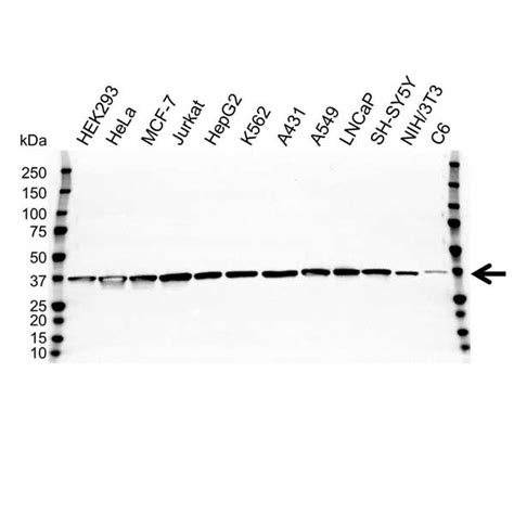 Anti GAPDH Antibody (PrecisionAb™ Polyclonal Antibody) | Bio-Rad