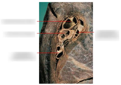 Y Respiratory Anatomy Left Hilum Of Lung Diagram Quizlet