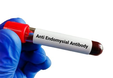 Premium Photo | Blood sample for anti endomysial antibody test for the diagnosis of celiac disease