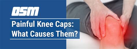 Painful Knee Caps: What Causes Them? - Orthopedic & Sports Medicine