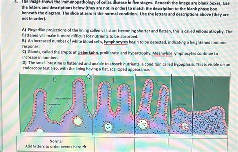 Solved The Image Shows The Immunopathology Of Celiac Disease Chegg