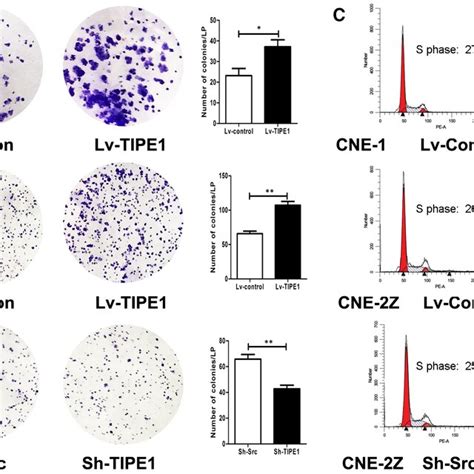 Tipe1 Promotes Nasopharyngeal Carcinoma Cell Proliferation In Vitro