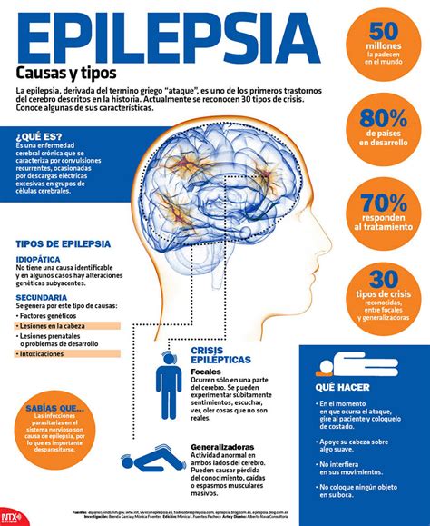 Epilepsia O Que Causas Sintomas Tratamento Imagens Hot Sex Picture