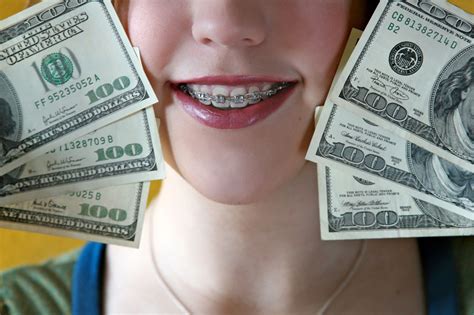 What Can Orthodontists Do to Make Braces More Affordable? - Charleston ...